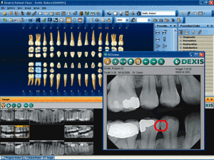 dental-imaging_3