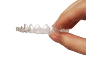 invisalign-3