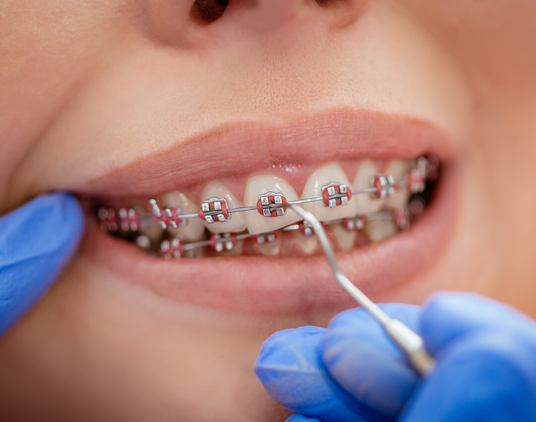 service-madison-dental-art