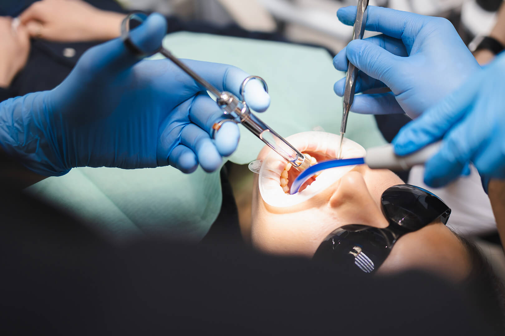 Oral Surgery | Madison Dental Art