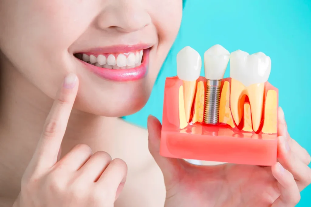 Can I Get Dental Implants After Dentures Heres What to Know Can I Get Dental Implants After Dentures? Here’s What to Know