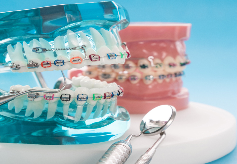 Cosmetic Dentistry for Crooked Teeth: Options for a Straighter, Beautiful Smile 1 Cosmetic Dentistry for Crooked Teeth Options for a Straighter Beautiful Smile Cosmetic Dentistry for Crooked Teeth: Options for a Straighter, Beautiful Smile