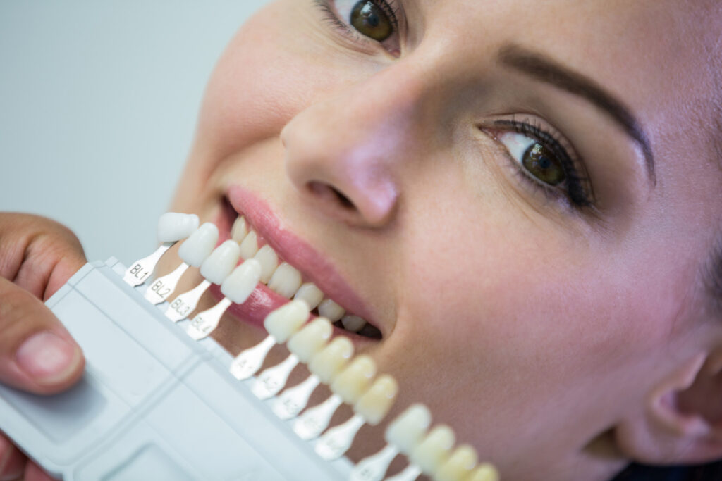 Can Dental Crowns Be Whitened? What You Need to Know 1 Can Dental Crowns Be Whitened What You Need to Know Can Dental Crowns Be Whitened? What You Need to Know