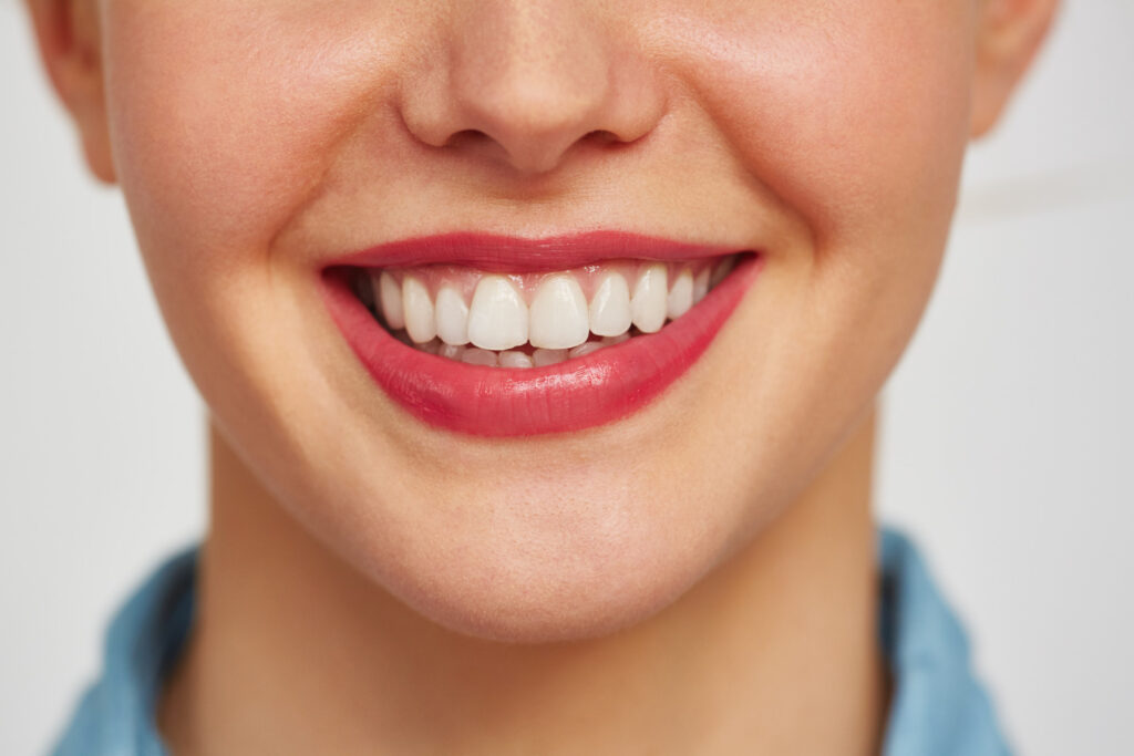 Will Dental Insurance Cover Teeth Whitening Costs Will Dental Insurance Cover Teeth Whitening Costs?
