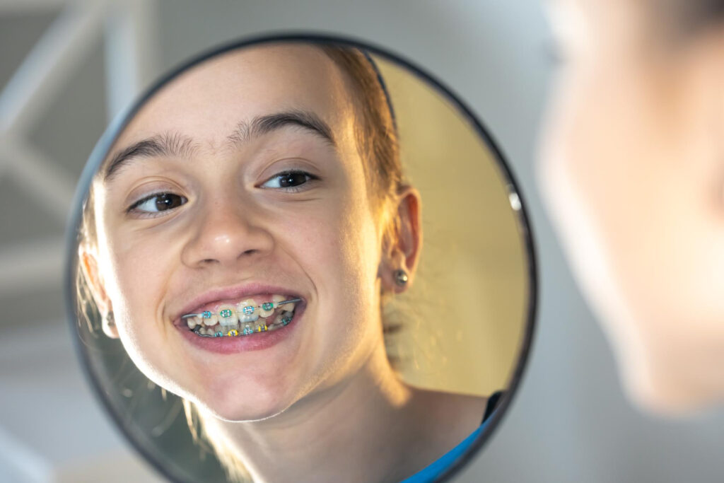 How to Get Rid of Swollen Gums with Braces Overnight 1 How to Get Rid of Swollen Gums with Braces Overnight How to Get Rid of Swollen Gums with Braces Overnight