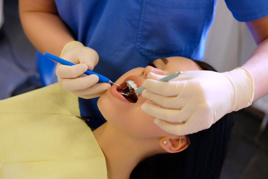 Is it Possible to Get a Cavity Under a Filling? 1 Is it Possible to Get a Cavity Under a Filling Is it Possible to Get a Cavity Under a Filling?