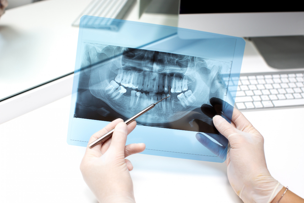 Oral Surgeon In Forest Hills, Queens 4 7685 Oral Surgeon In Forest Hills, Queens