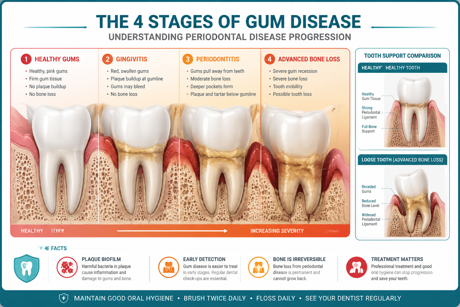 How to Prevent Tooth Loss from Gum Disease: Tips That Actually Work 1 4 stages of gum disease