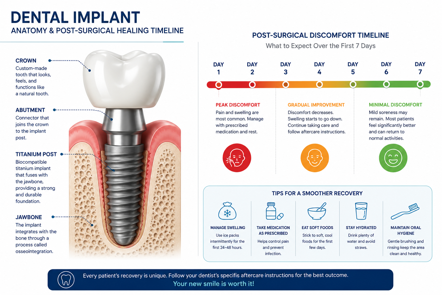 Is It Normal to Experience Pain After Dental Implant Surgery? 1 Dental Implant Anatomy