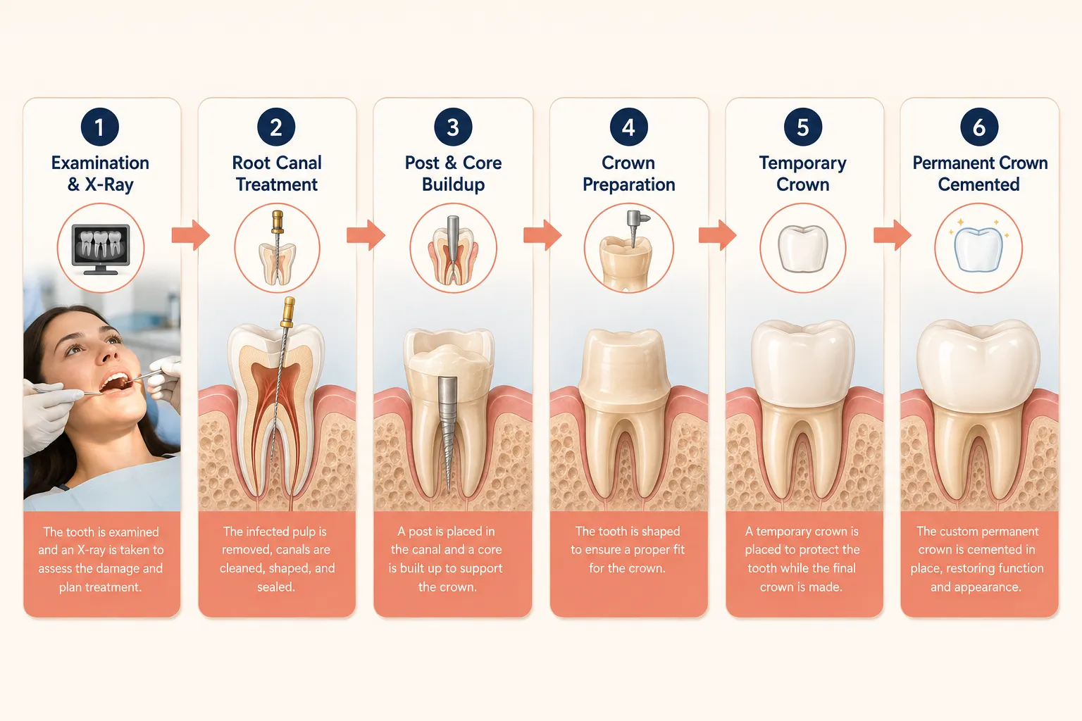 The Crown Dead Tooth Procedure: Step by Step