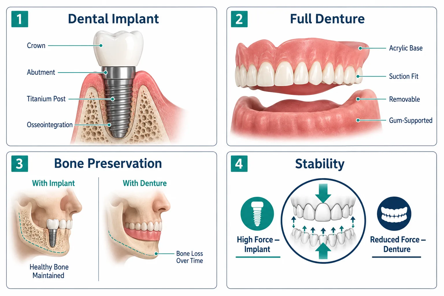 What Is the Difference Between Dental Implants and Dentures? 2 Core Difference Between Dental Implants and Dentures