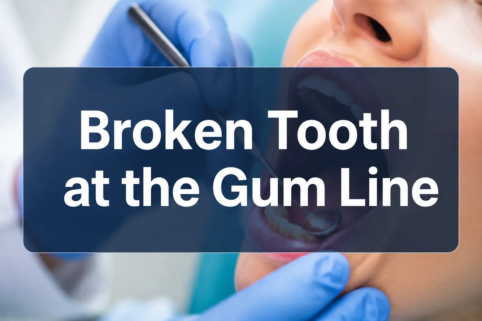 13 Removing a Broken Tooth at the Gum Line: What You Need to Know