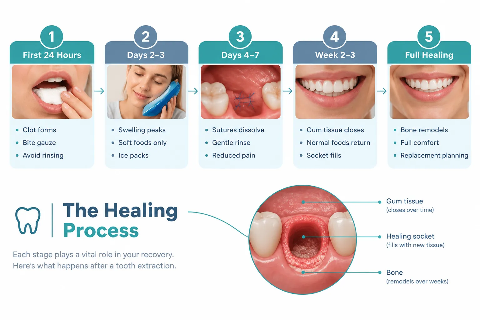 Tooth Extraction Recovery: A Complete Guide to Healing Safely and Comfortably 2 Understanding the Tooth Extraction Recovery Timeline