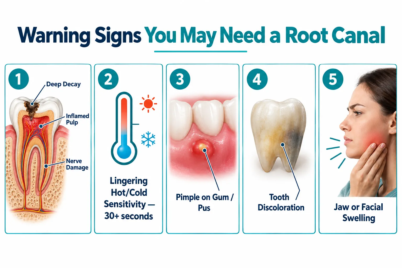 Warning Signs That Suggest You May Need a Root Canal