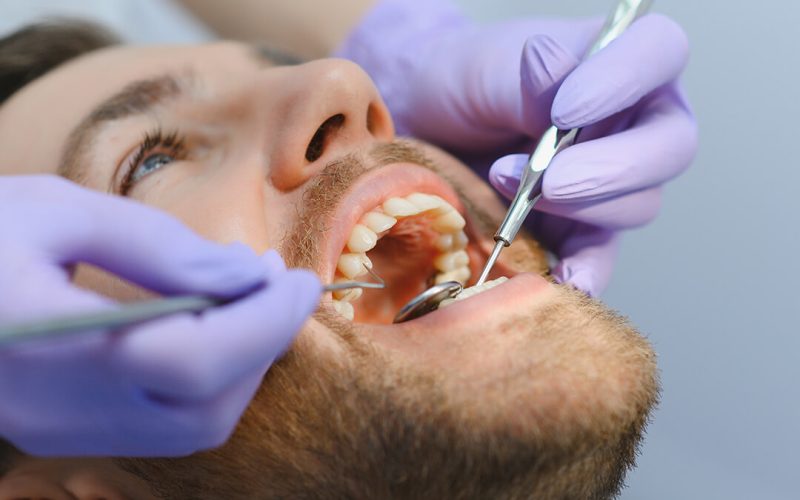 fillings02